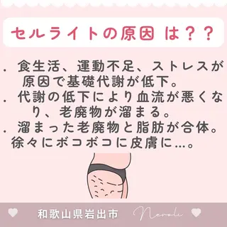 温活beautyサロンNeroli所属・切らない脂肪吸引🔥 Neroliまりこのエステ・リラクイメージ