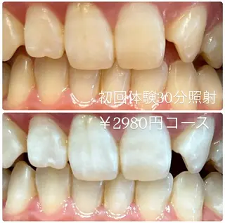 PLATINUM Beauty 横浜店所属・ホワイトニングルーム 横浜店のその他イメージ