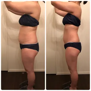 FLEUR大阪・美容 整体・痩身・小顔のエステ・リラクイメージ