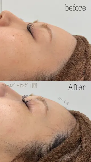 肌質改善|美眉サロンCannone'所属・肌質改善|美眉サロン Cannone’の眉毛・アイブロウイメージ