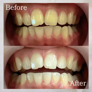 LBSホワイトニング 🌐岡山店のその他イメージ