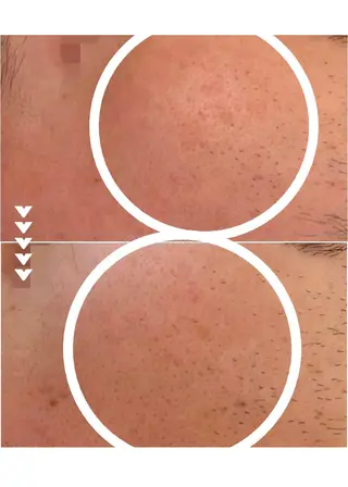 肌質改善 KALANCHOEのエステ・リラクイメージ