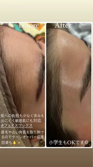 sourire.11 ‪☺︎‬‪emiのエステ・リラクイメージ