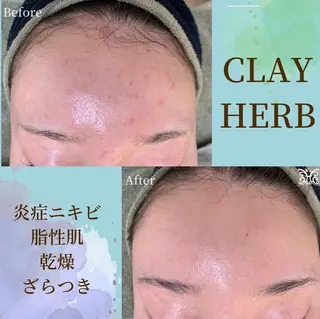 VIKI BEAUTY  クレイハーブピーリング・美肌脱毛専門店所属・VIKI BEAUTYのエステ・リラクイメージ