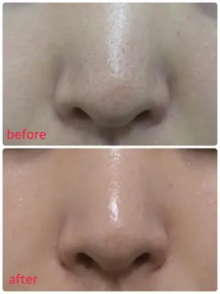 美SORA ～ｳﾞｨｿﾗ～のネイルデザイン