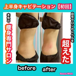 痩身/脱毛/ネイル HARUKAのエステ・リラクイメージ