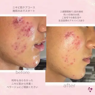 ベラージュ【美背中・ 美尻・フェイシャル】のエステ・リラクイメージ