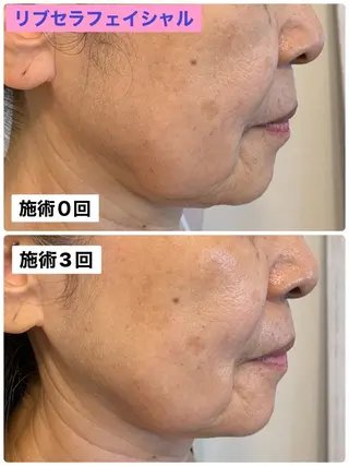 Private Salon Prunelle所属・プライベートサロン プリュネルのエステ・リラクイメージ