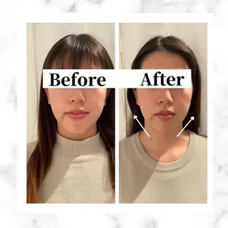 12Dハイフ💗 最強小顔のエステ・リラクイメージ