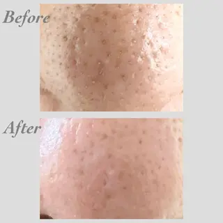 メンズ 小顔・ツルツル素肌 ハリステリアのエステ・リラクイメージ