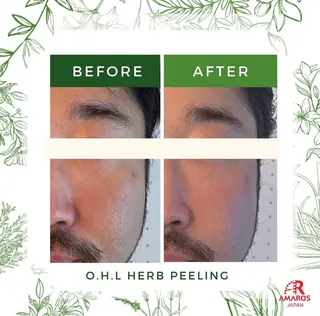 メンズ アイブロウサロンMily所属・眉毛/美肌の専門店 Mily🍒ミウィの眉毛・アイブロウイメージ