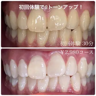 ホワイトニングルーム　川崎店所属・ホワイトニング ルーム　川崎店のその他イメージ