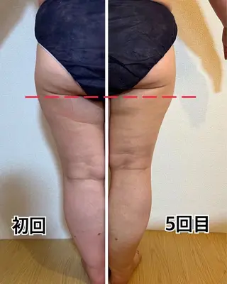 ❤︎MN❤︎ モンのエステ・リラクイメージ