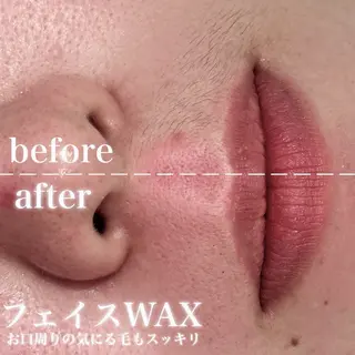 毛穴ケア・脱毛 /FOXY LASHのエステ・リラクイメージ