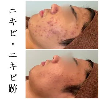 ハーブピーリング専門 BIOEL横浜のエステ・リラクイメージ