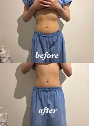 メンズ 腸活サポート みなみののエステ・リラクイメージ