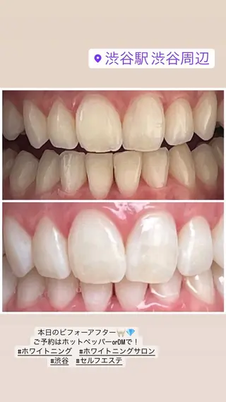 💎ダイヤモンド ホワイトニング渋谷のその他イメージ