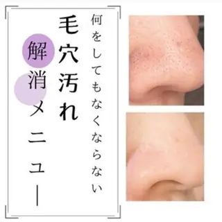 Jessica 豊島のマツエク・マツパデザイン