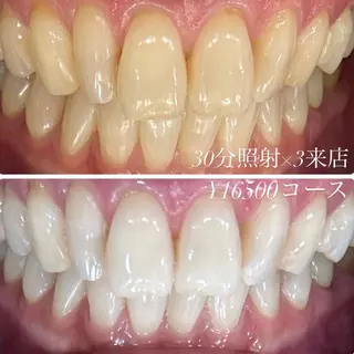 ホワイトニングルーム　川崎店所属・ホワイトニング ルーム　川崎店のその他イメージ