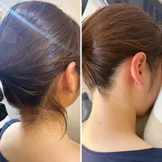 うなじ脱毛/美肌脱毛 LABELのエステ・リラクイメージ