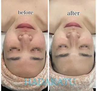 総合エステサロン 肌活のエステ・リラクイメージ