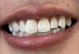 セルフホワイトニングサロン　ラヴィアン所属・ホワイトニングサロン La vie enのその他イメージ