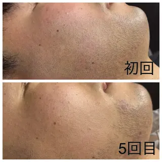 メンズ歓迎👑美肌 ✖️小顔🌿レイのエステ・リラクイメージ