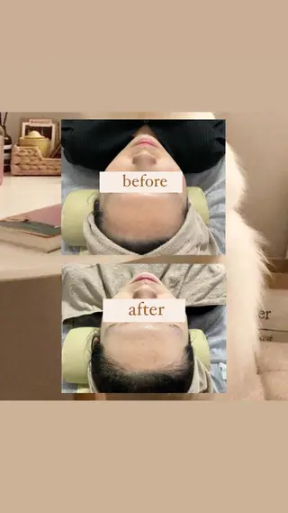 crescent所属・【韓国肌管理・脱毛】 クレセントのエステ・リラクイメージ