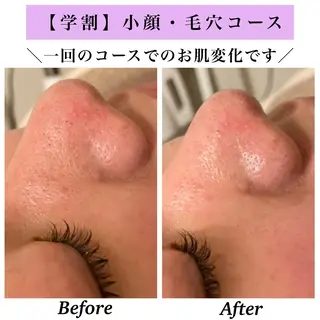 Bellesthe (ベルエステ)のエステ・リラクイメージ