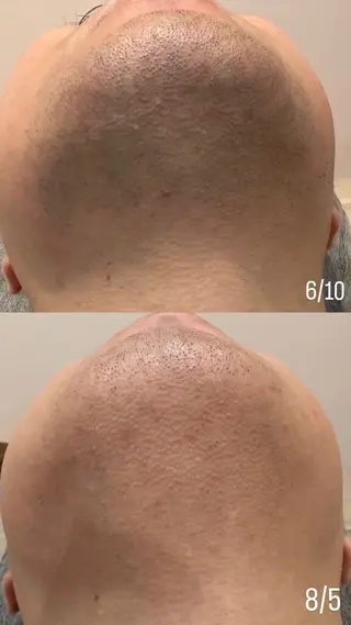 セミロング カラー パーマ ヘアアレンジ メンズ キッズ ネイル マツエク・マツパ アイブロウ Amaryllis 🌹松本のエステ・リラクイメージ