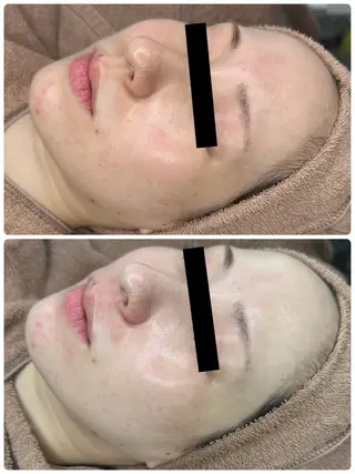 BeautySalon　Eclaleum所属・Eclaleum MAIのエステ・リラクイメージ