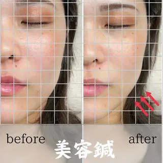 市川本八幡リーフ整骨院所属・女性のための鍼灸師 かえで𓎤𓅮のエステ・リラクイメージ