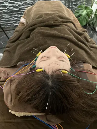 美容鍼灸整体サロンBeauJu所属・小顔矯/美容鍼/鍼灸 BeauJuのその他イメージ