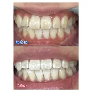 MBEAUTYSALON 千葉店・京成大久保所属・Melty 輝のその他イメージ