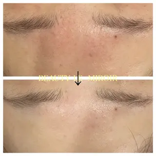 ビューティー ミロワールのエステ・リラクイメージ