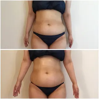 美容マッサージ Urichのエステ・リラクイメージ