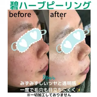 肌質体質改善サロン 🌿ミュリール橋本店のエステ・リラクイメージ