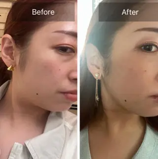 美脚マエストラ 上野由理のエステ・リラクイメージ