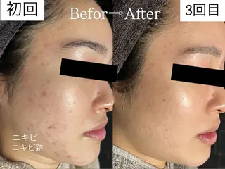 rejena 山口のエステ・リラクイメージ