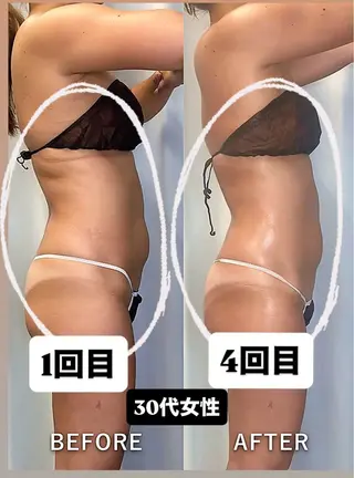 美容整体・塗る漢方・フェイシャルRechica所属・心斎橋痩身 美容整体×肌管理のエステ・リラクイメージ