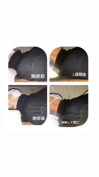 【足圧】鬼👹リンパ 身体整うサロンのエステ・リラクイメージ