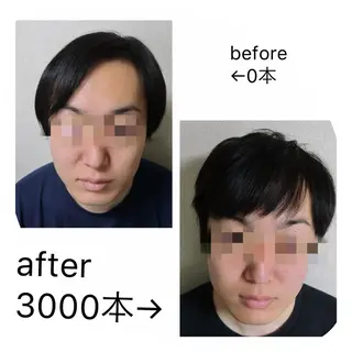 痛ネイル/ワンホン/ フィルイン/長さだしのネイルデザイン