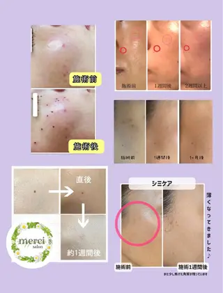 バストアップ専門/ ボディケア/小顔のエステ・リラクイメージ