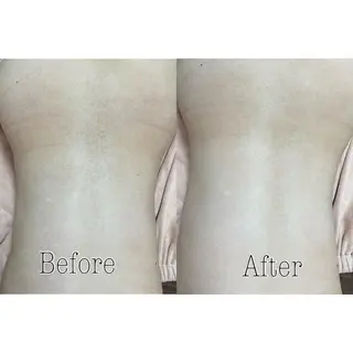 都度払い制脱毛サロンBe Charm所属・Be Charm 山﨑のエステ・リラクイメージ