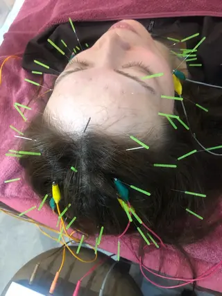 美容鍼灸女性専用 りんご鍼灸治療院のその他イメージ