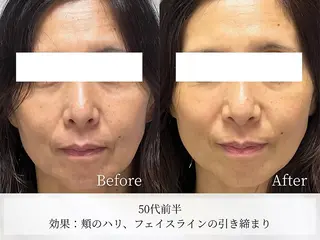 Astorie 相模大野エステのその他イメージ