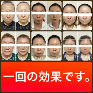 ニキビ・ 肌荒れ専門店のエステ・リラクイメージ