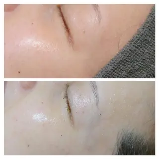 Beauty Salon Luana所属・Luanaまつパ脱毛 ハーブピーリング眉毛のマツエク・マツパデザイン