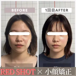 小顔矯正専門店 【RED】池田のエステ・リラクイメージ