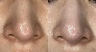 sii センター北 AIのエステ・リラクイメージ